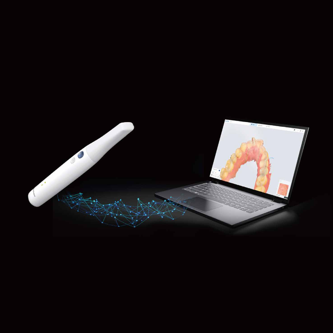 SENSA Wireless Intraoral Scanner + Laptop