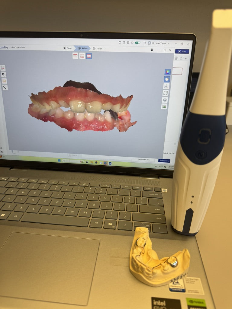 Alliedstar AS200E Wireless Intraoral Scanner + Laptop